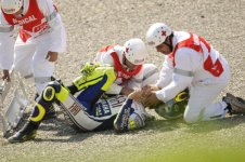 rossi-leg.jpg